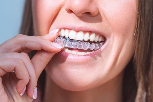 Woman putting a clear aligner in her mouth, huntsville al