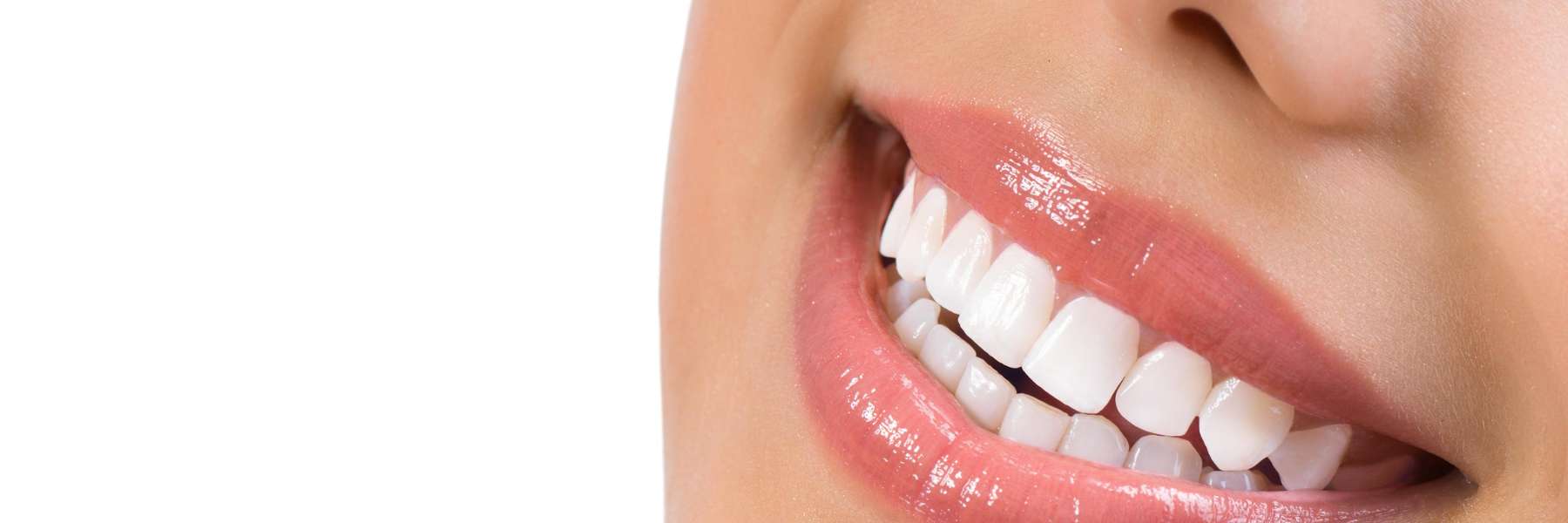 Smiling woman | Veneers Huntsville Alabama