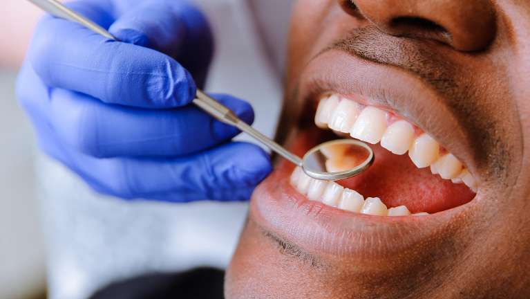Man getting a dental exam