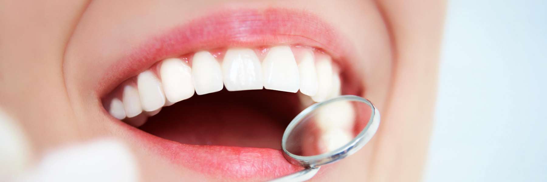 A woman getting a dental exam Huntsville AL
