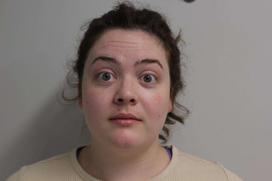 Woman before botox, huntsville al