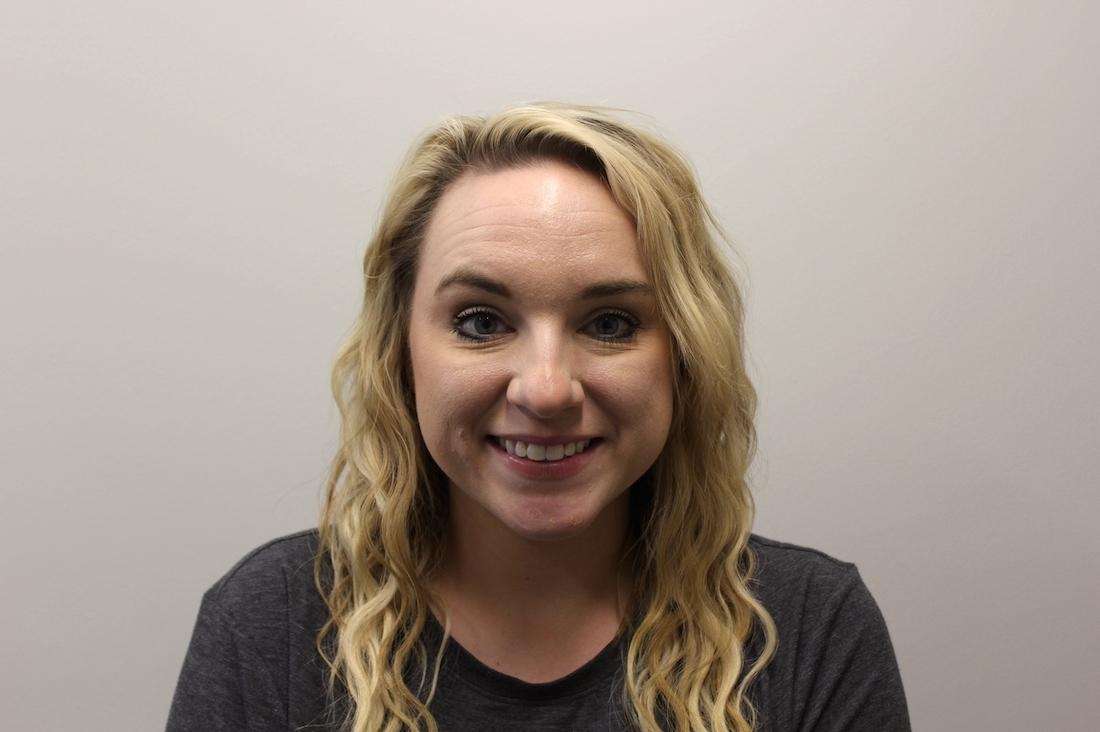Woman smiling before botox treatment, huntsville al
