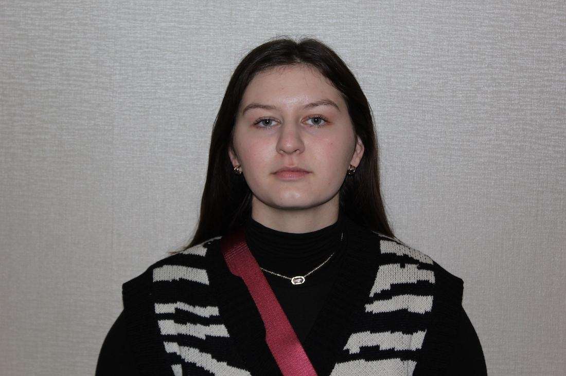 Girl before lip enhancement, huntsville al