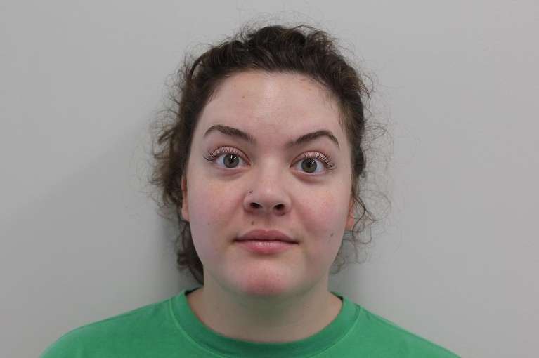 Botox-for-Forehead-and-11-s-After-Image