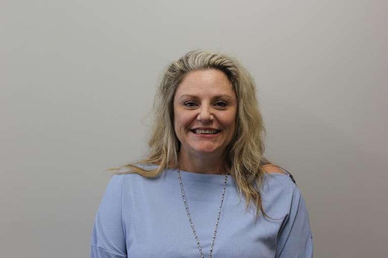 Woman after botulinum toxin facial smoothing, huntsville al