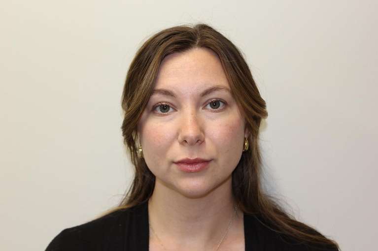 Woman after light lip enhancement, huntsville al