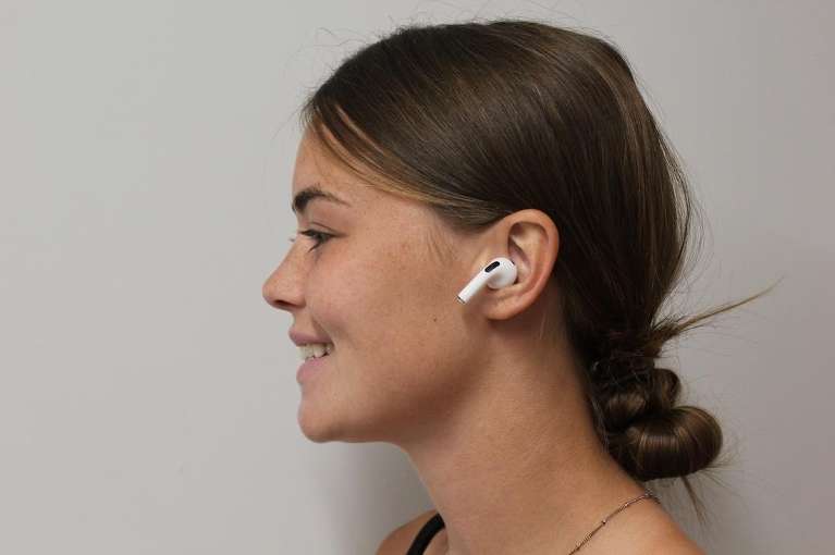 Close up of womens smile after lip enhancement, huntsville al