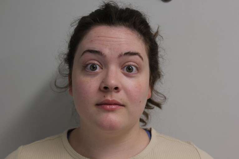 Botox-for-Forehead-and-11-s-Before-Image