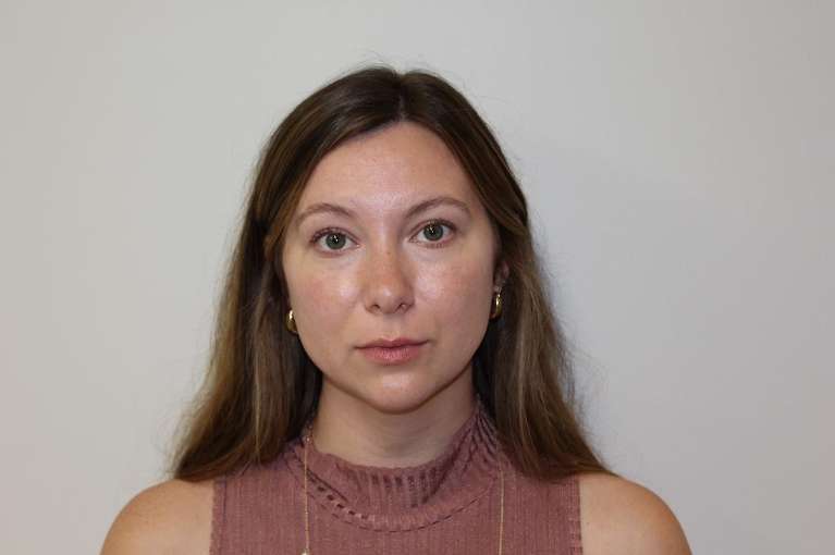 Woman before light lip enhancement, huntsville al