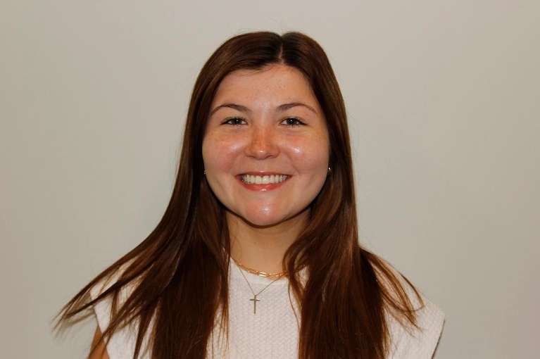 Woman before lip enhancement, huntsville al