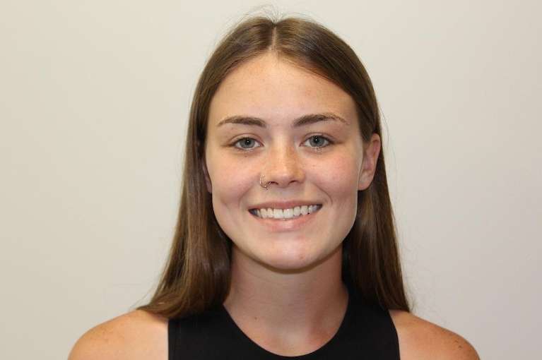 Close up of womens smile before lip enhancement, huntsville al