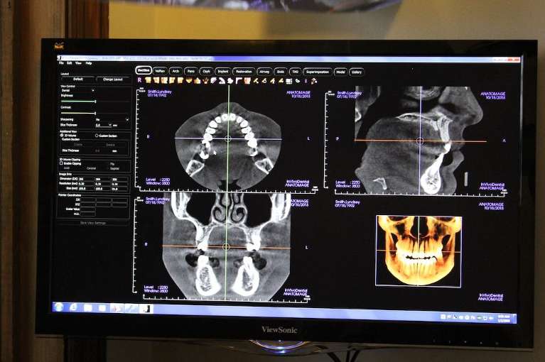 Digital x-rays at twickenham family dentistry in Huntsville, AL